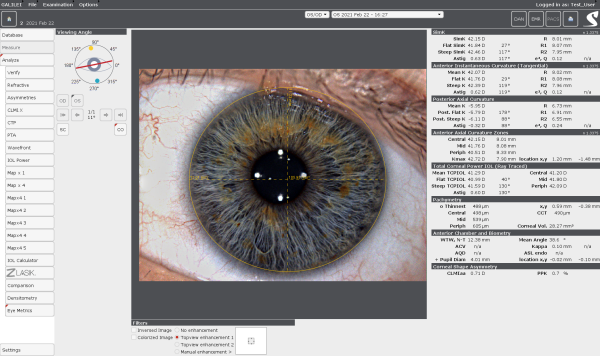 Die Eye Metrics Darstellung lässt sich bei verschiedenen Eingriffen nutzen. Trübungen innerhalb der Hornhaut können damit lokalisiert werden.